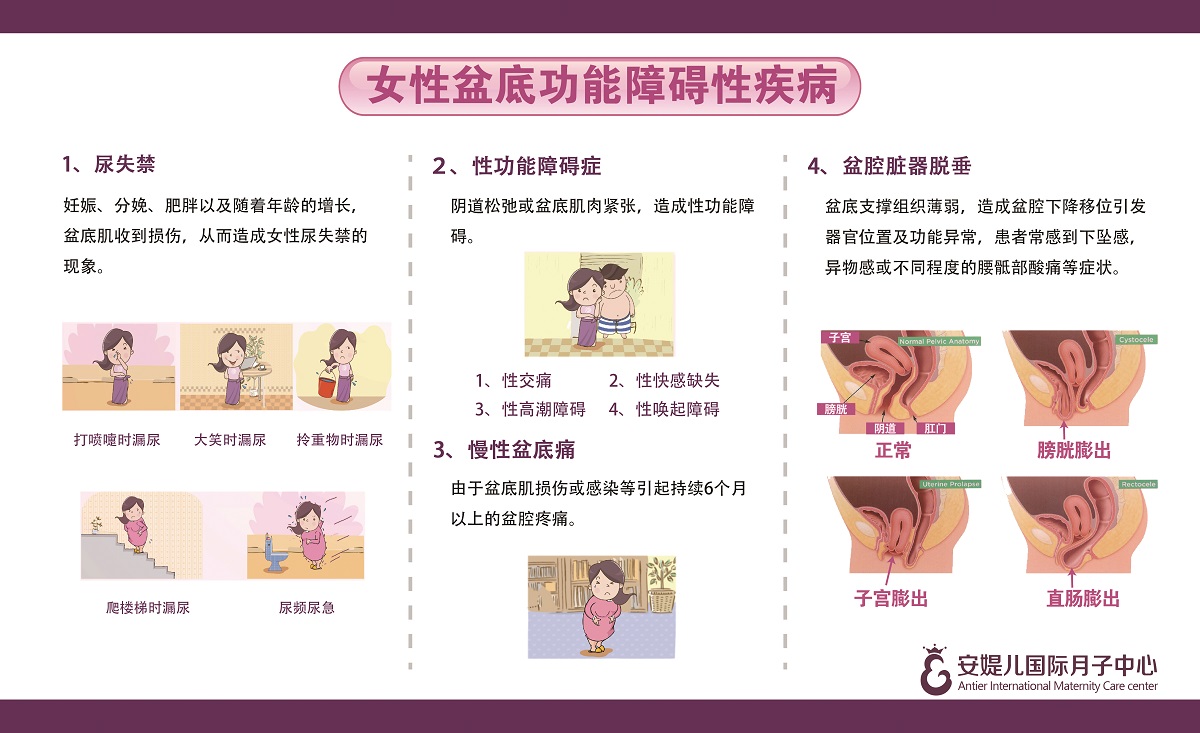 女性盆底功能障碍性疾病.jpg 女性盆底功能障碍性疾病.jpg